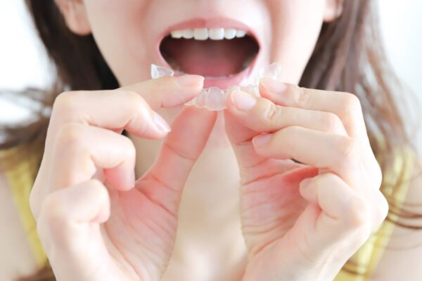 相模原古淵の矯正歯科が解説。インビザライン治療の進め方とは？