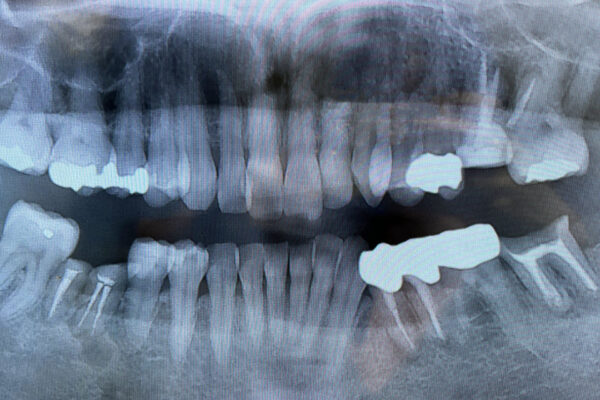 相模原古淵の矯正歯科が答える 「よくある歯のトラブルにはどんな種類がある？」