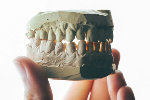 相模原・古淵の矯正歯科が答える「よくある歯のトラブルと予防法とは？」